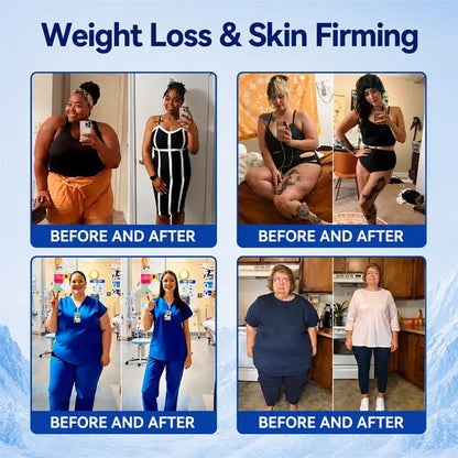 Virexo™  Cryo Sculpt Mist 4-in-1: Adaptive fat-sculpting technology, intelligent cooling, skin defense, and freshness.